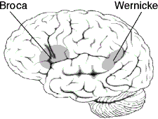 A drawing illustrating Brocas and Wernickes areas in the human brain.