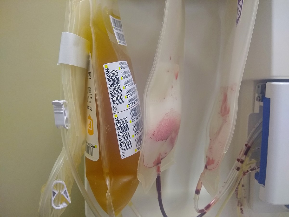 IV bags containing convalescent plasma.