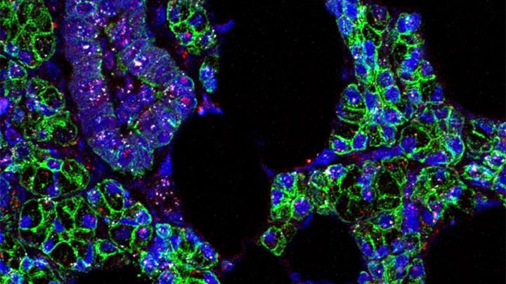 Human salivary gland cells.