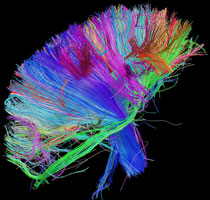 Image: white matter fibers in the brain