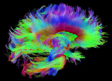 An image from the Human Connectome Project, which shows the abundance and complexity of white matter nerve fibers in the human brain.