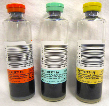 Photo of Blood Culture Tubes