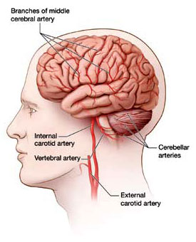 Carotid and Vertebral Arteries A lateral view of the human brain showng the carotid and vertebral arteries.