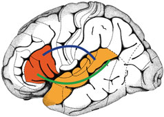 Brocas and Wernickes areas are highlighted in red and orange. The blue and green lines illustrate connections that link the two regions with one another and form a network of language areas. 