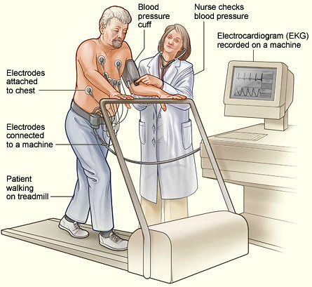 A patient undergoing a cardiac stress test.