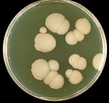 Photo of Agar Plate Culture of C. Albicans