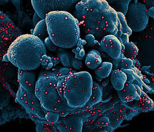 scanning electron micrograph of cell infected with SARS-COV-2 virus