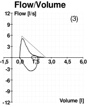 A graph showing peak flow volume for a patient with asthma.