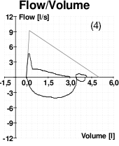 A graph showing peak flow volume for a patient with COPD.