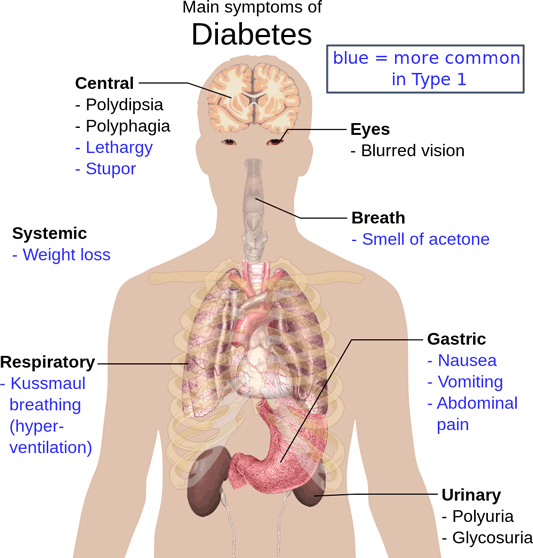 Image: Main Symptoms of Diabetes