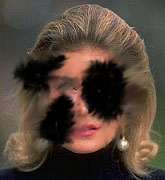 A photograph of a woman's face showing how vision is affected by diabetic retinopathy.