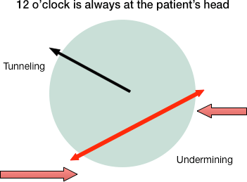 Chart for Documenting Wounds