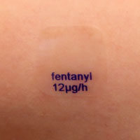 A photo showing a transdermal fentanyl patch on a person's skin.