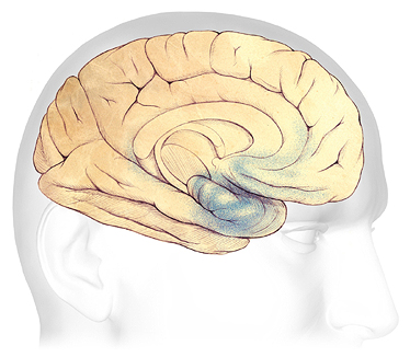 An illustration of the changes in the brain associated with mild dementia.