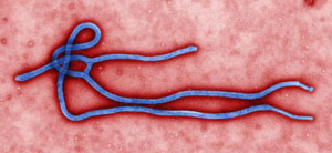 Microscopic Image of an Ebola Virus Particle