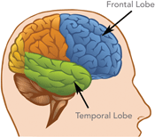 A drawing of the brain showing the location of the frontal lobe