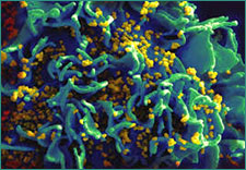 HIV virus for course introduction page