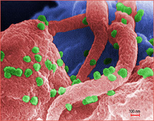 A scanning electron micrograph showing HIV-1 virions on the surface of a human lymphocyte.