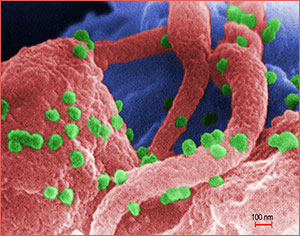 A scanning electron micrograph showing HIV-1 virions on the surface of a human lymphocyte. 