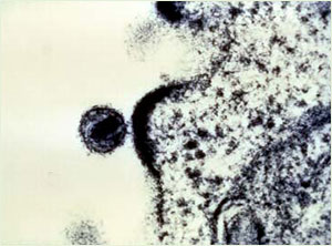 HIV “budding” out of a T-cell.