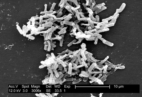 Scanning electron micrograph of Clostridium difficile bacteria from a stool sample.