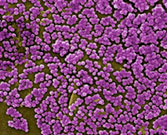 MRSA Bacteria Scanning electron micrograph depicting clumps of MRSA bacteria.