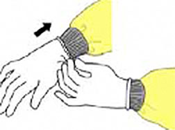 A drawing showing the proper procedure for donning gloves.