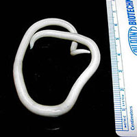 A photograph of the parasitic roundworm Ascaris lumbricoides.