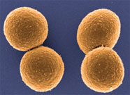 A colored electron micrograph of S. aureus bacteria. 