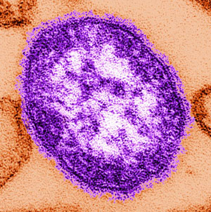 A measles particle.