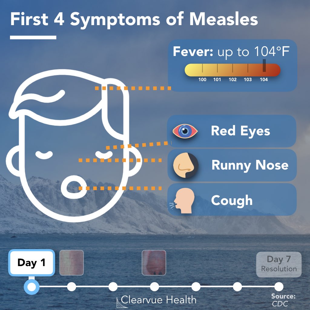 Graphic: first 4 measles symptoms Graphic: first 4 measles symptoms