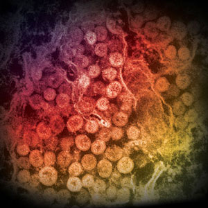 Electron micrograph of a thin section of MERS-CoV