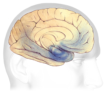 The areas of the brain damaged due to moderate dementia.