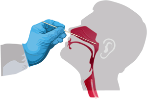 Gathering a Respiratory Specimen: Nasopharyngeal Swab