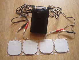 TENS (Transcutaneous Electrical Nerve Stimulator)