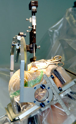 Photo of Patient Undergoing DBS Surgery