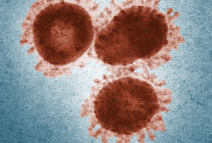SARS Virus Particles SARS Virus Particles