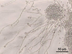 Pseudo Hyphae of Candida albicans