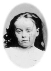 An 1874 photograph of Mary Ellen Wilson.