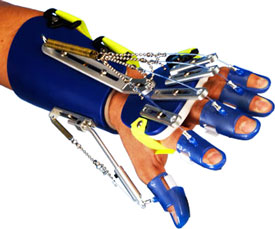 A photograph of the Saeboflex dynamic hand orthosis, used to aid in active movement of the hand.