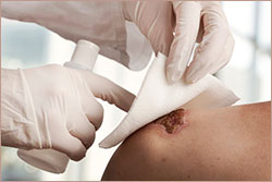 Wound Care Course Introduction Photo
